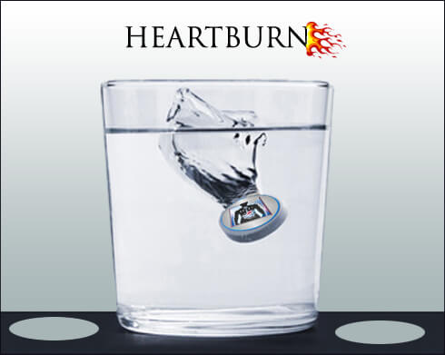 Heartburn Causes reasons