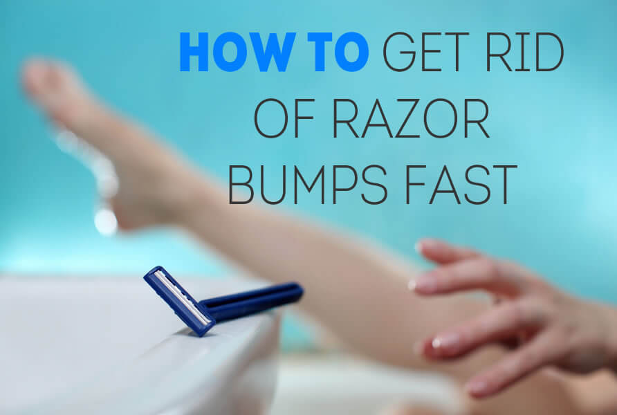 How To Get Rid Of Razor Bump