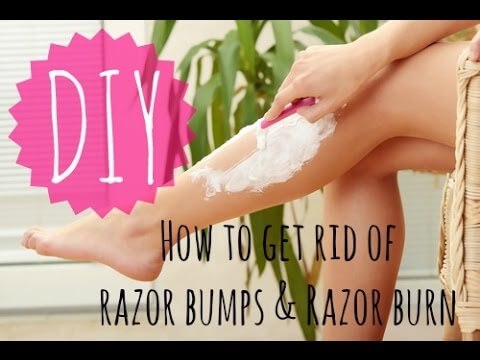 How To Get Rid Of Razor Bumps & Burns