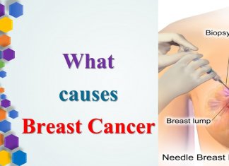 causes of breast cancer